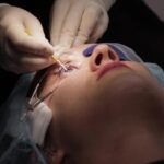 Visual Freedom Redefined: The Transformative Impact of Laser Eye Surgery